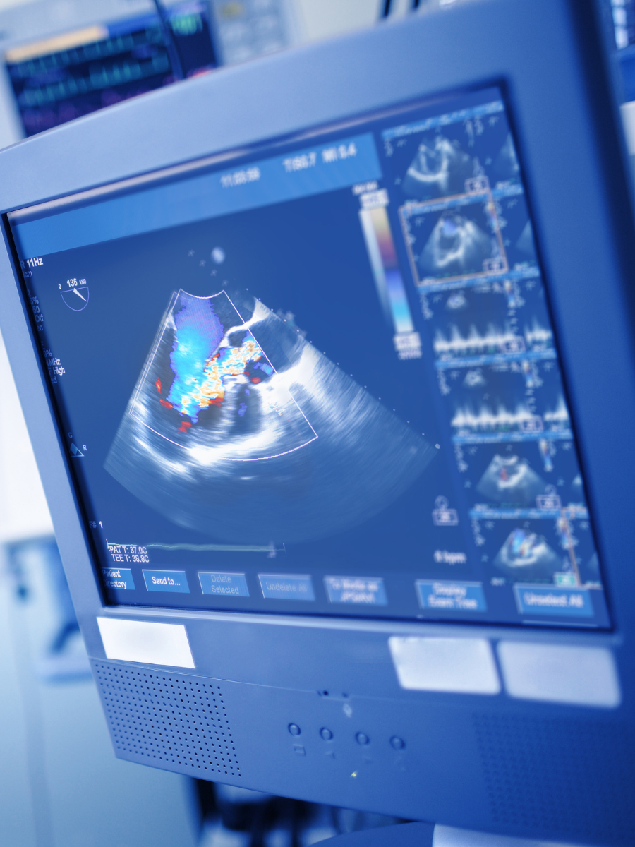 Global UX Considerations for Medical Devices-featured